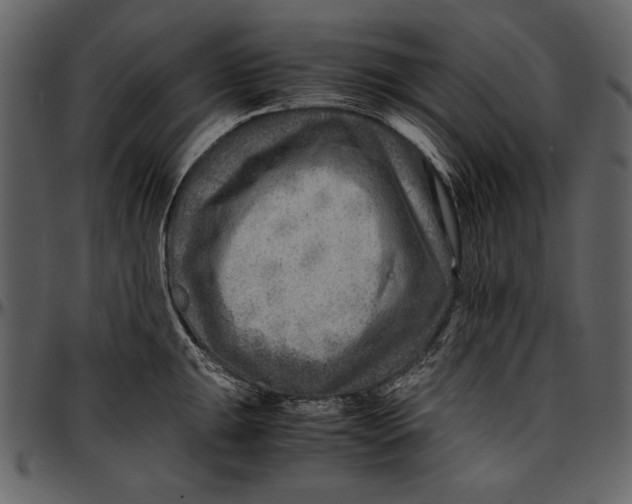 X0000096941047200802291028