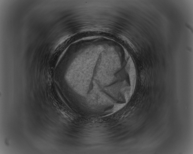 X0000096941064200802291027