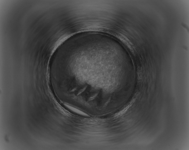 X0000096941077200802291027