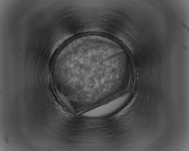 X0000096941117200802291026