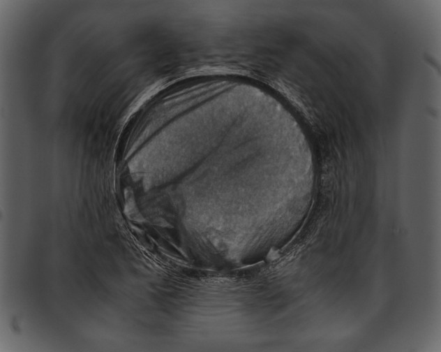 X0000096941173200802291025