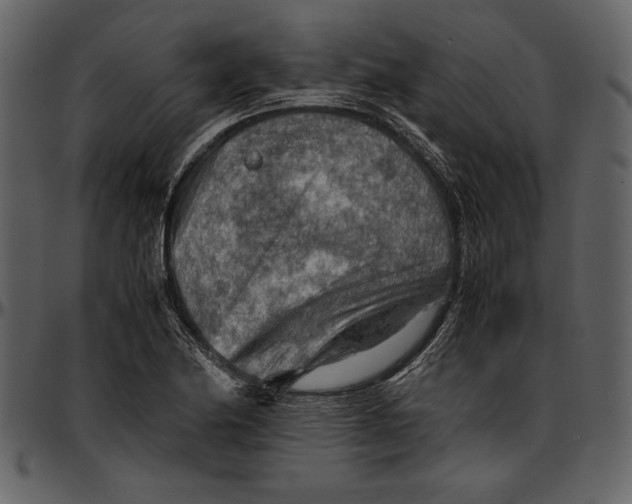 X0000096941174200802291025