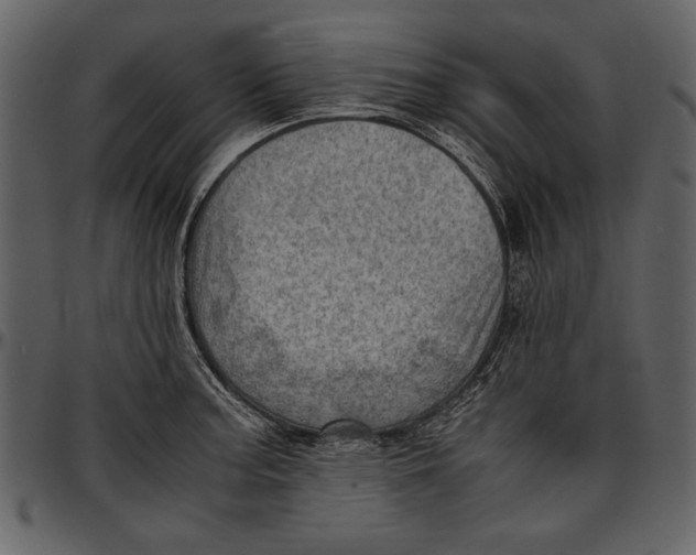 X0000096941187200802291025