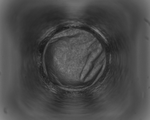 X0000096941399200802291021