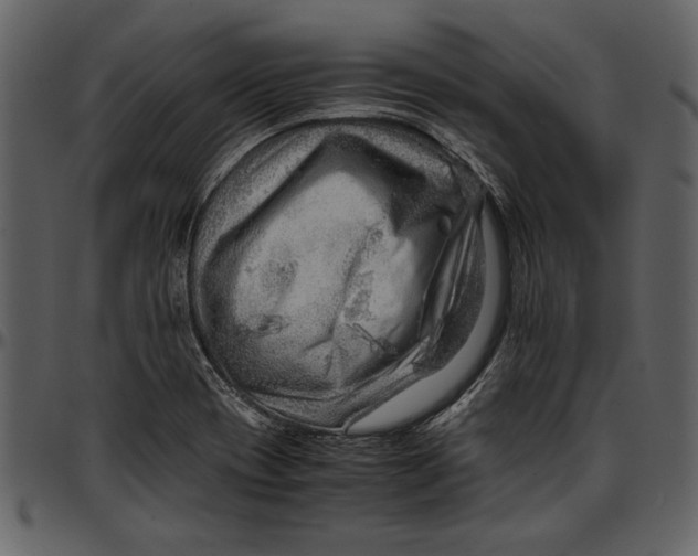 X0000096941417200802291021