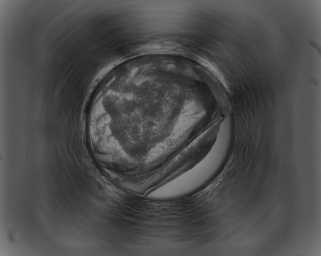 X0000096941419200802291021