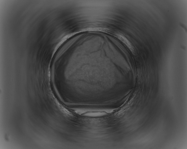 X0000096941428200802291022