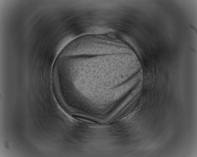 X0000096941487200802291020