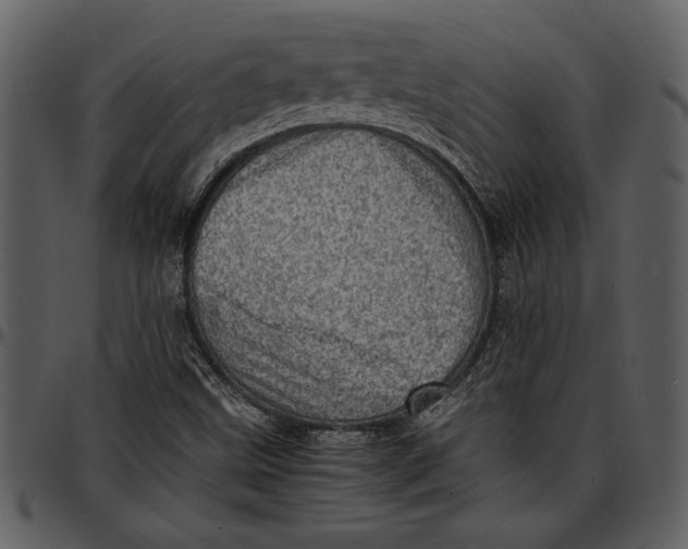 X0000096941499200802291020