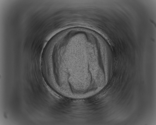 X0000096941535200802291020