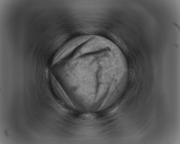 X0000096940117200803071014