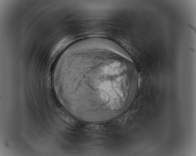 X0000096940339200803071011