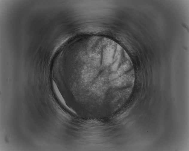 X0000096940399200803071010