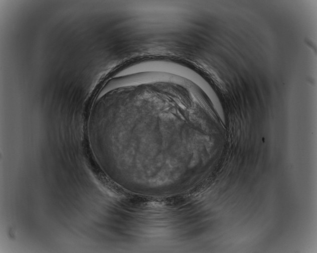 X0000096940496200803071009