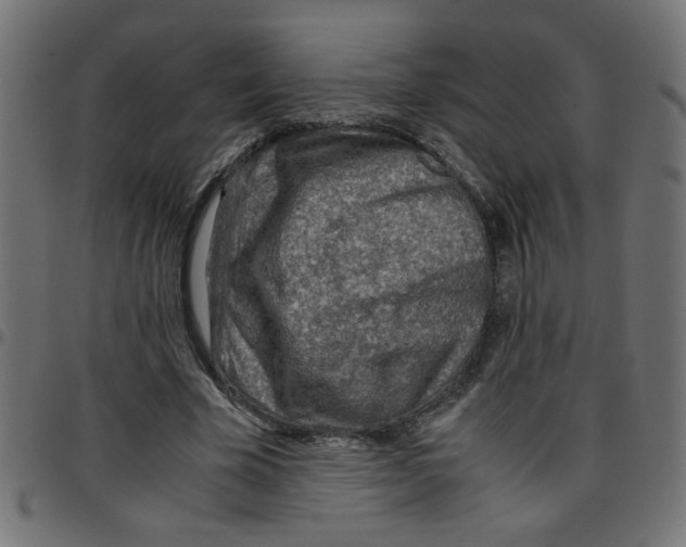 X0000096940585200803071008