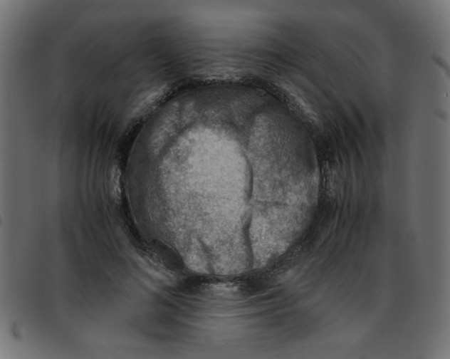 X0000096940692200803071006