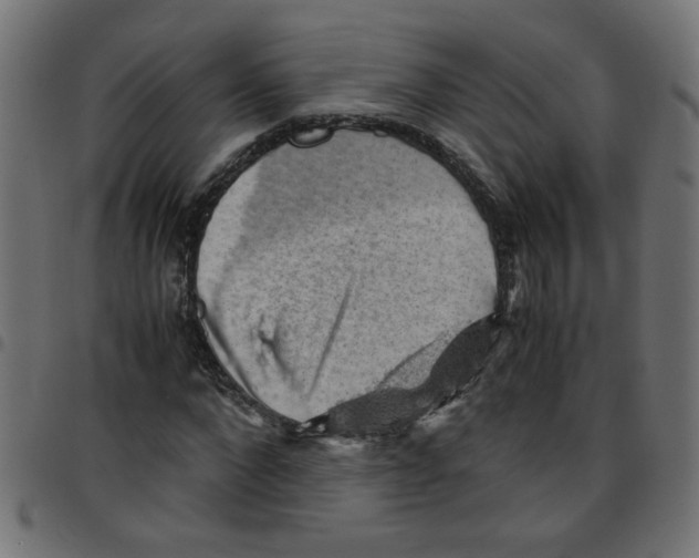 X0000096940872200803071004