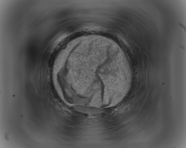 X0000096941016200803071001