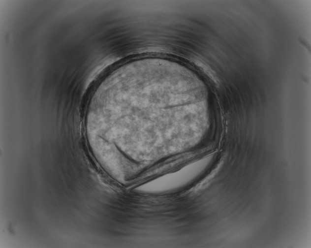 X0000096941117200803071000