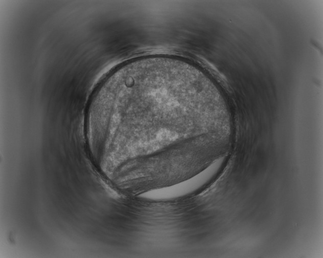 X0000096941174200803070959