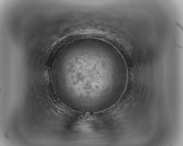 X0000096951493200802151225