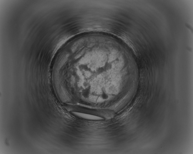 X0000096950879200802291053