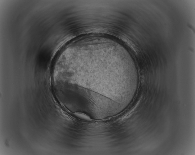 X0000096951117200802291050