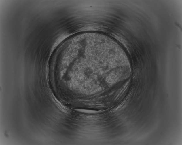 X0000096951179200802291049