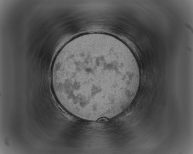 X0000096951191200802291049