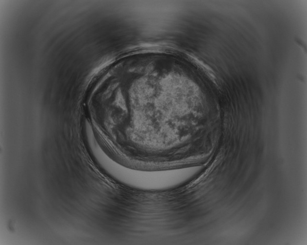 X0000096951411200802291045