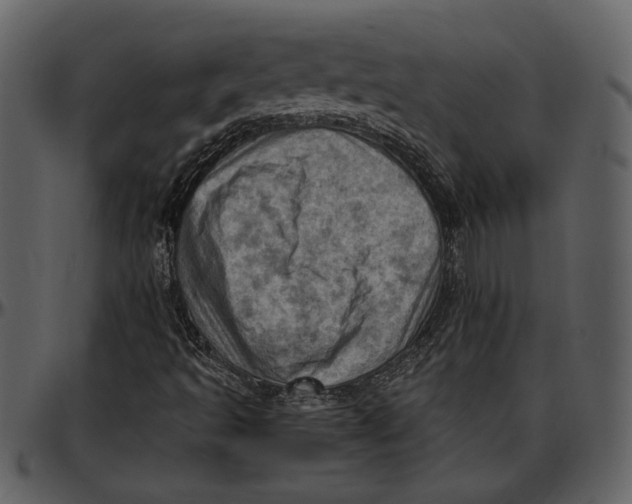 X0000096951493200802291044