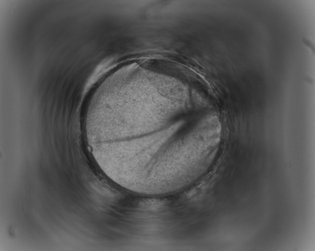 X0000096950198200803071035