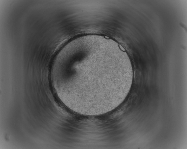 X0000096950201200803071035