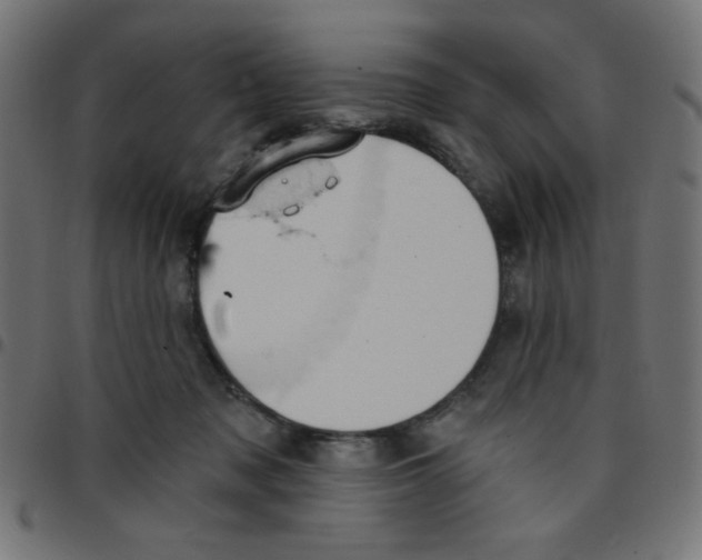 X0000096950317200803071034