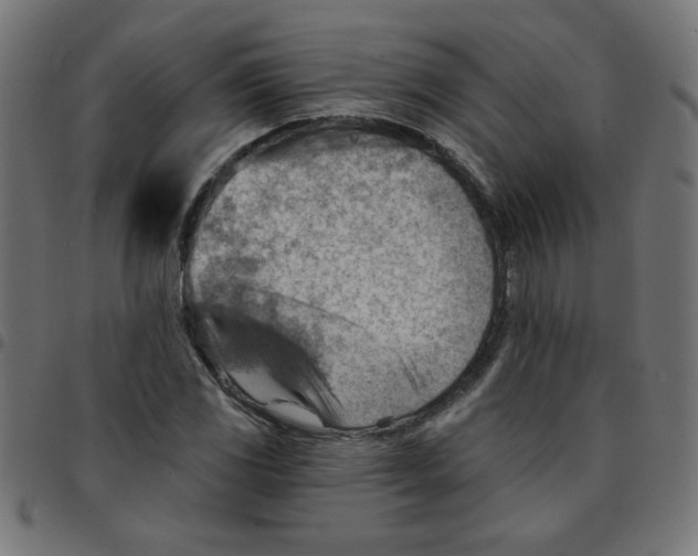 X0000096951117200803071022