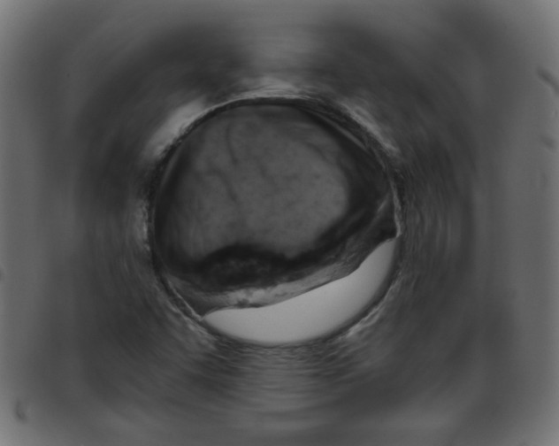 X0000096951455200803071017