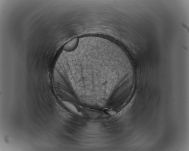 X0000096951497200803071016