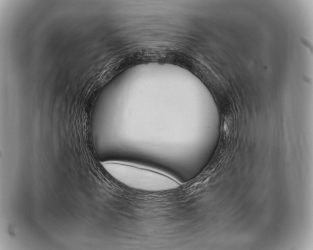X0000096960867200802080857