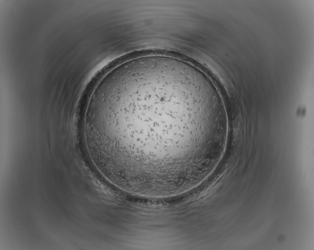 X0000096960975200802151232