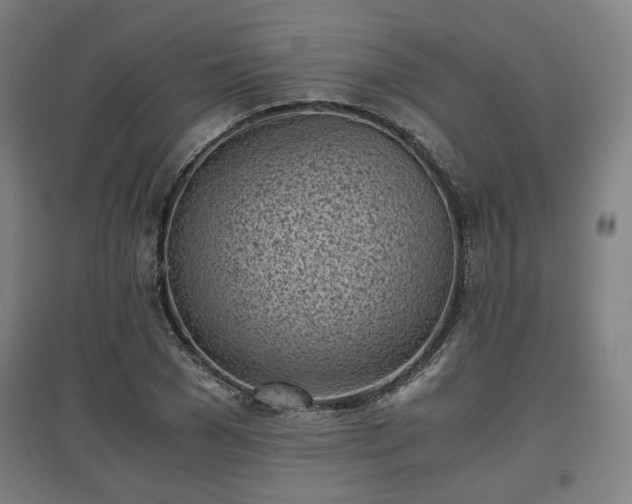 X0000096960977200802151232