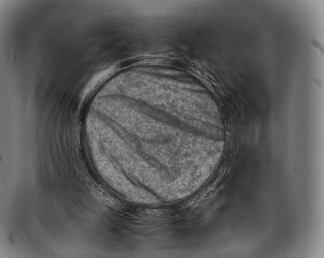 X0000096960149200802291129