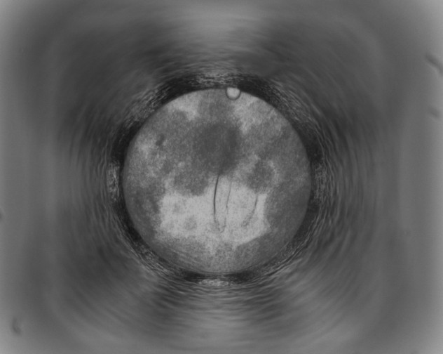 X0000096960699200802291121