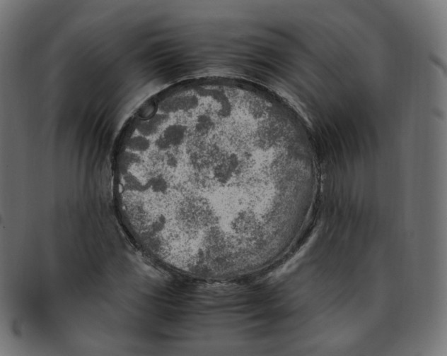 X0000096961117200803071045