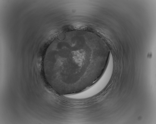 X0000096980319200802151336