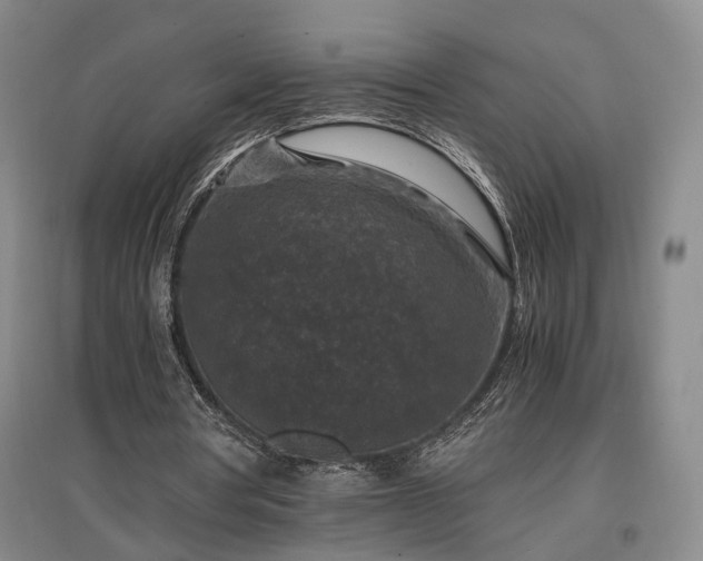 X0000096980386200802151335