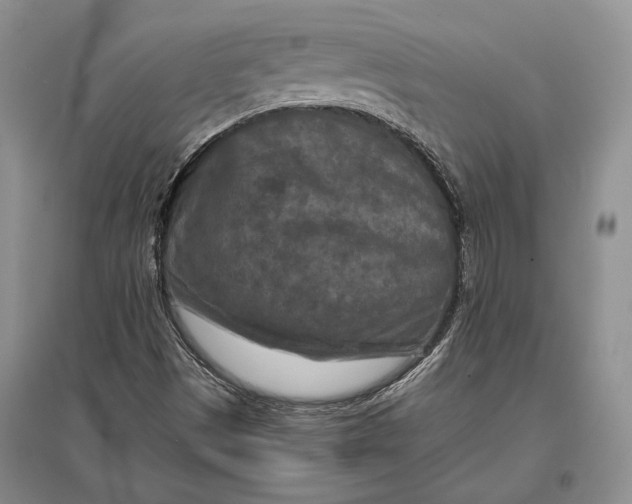 X0000096981497200802291133