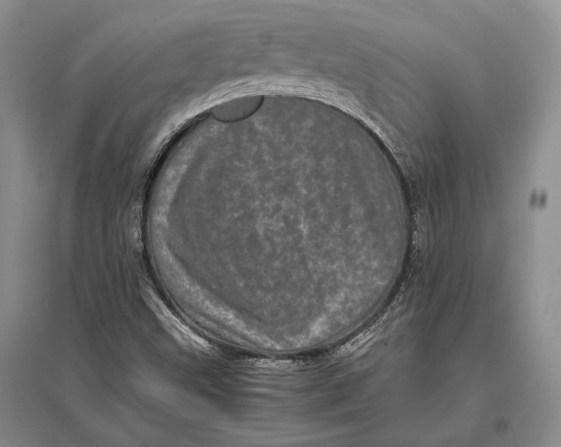 X0000096981499200802291133