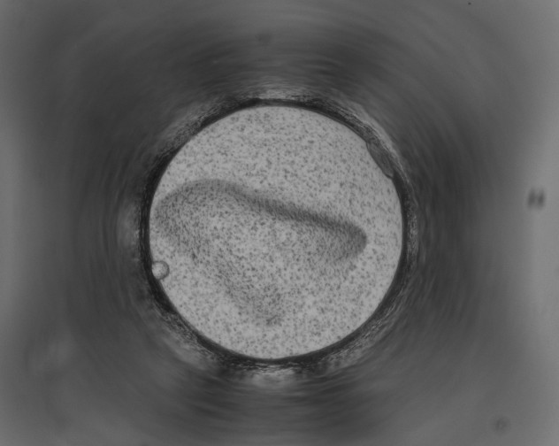 X0000096980257200803071036