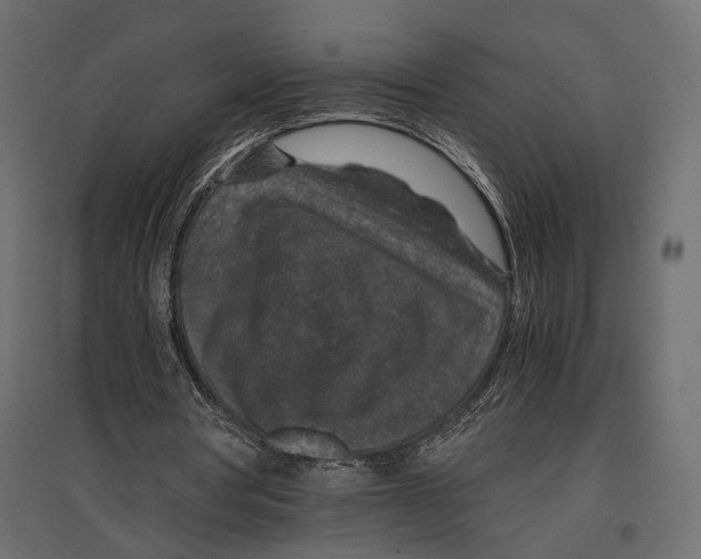 X0000096980386200803071035