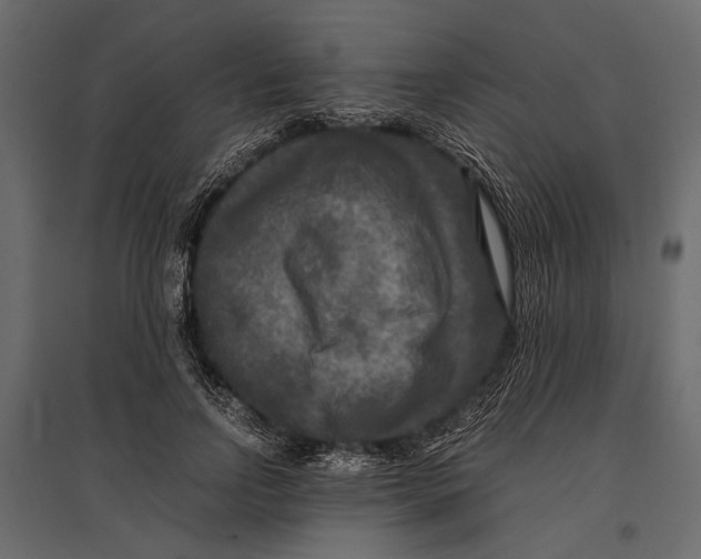 X0000096980742200803071029